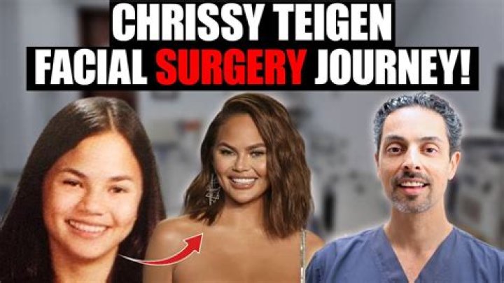 Chrissy Teigen Plastic Surgery: Chrissy's Openness with Representing True Self!