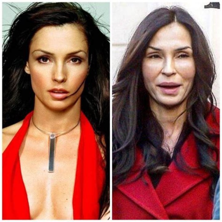 Famke Janssen Plastic Surgery Before and After