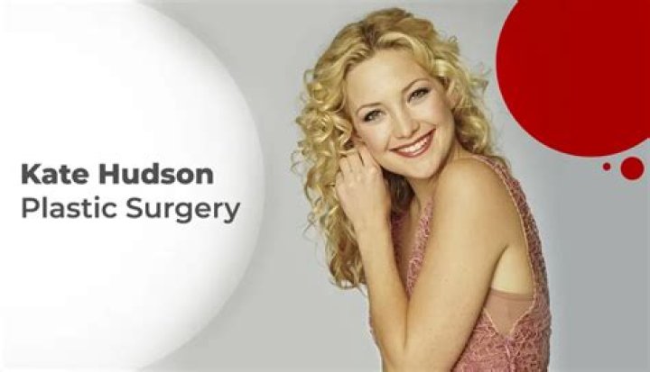 Kate Hudson Plastic Surgery: Hudson's Approach and Story of Undergoing Procedures!