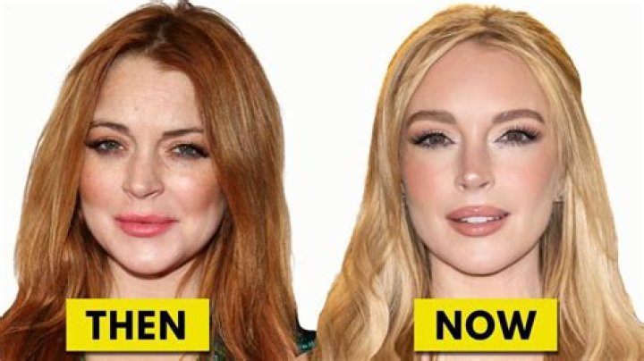 Lionel Richie Plastic Surgery: The Truth Behind the Plastic Surgery Speculations